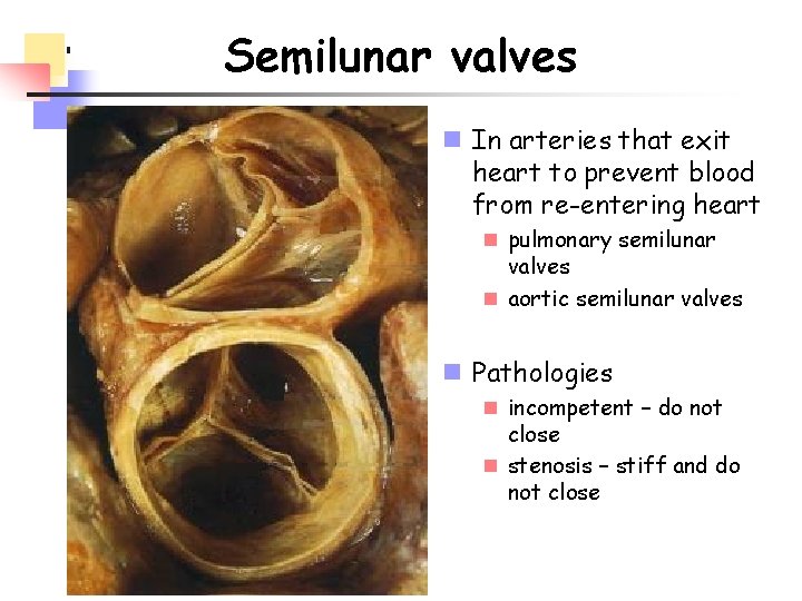 Semilunar valves n In arteries that exit heart to prevent blood from re-entering heart