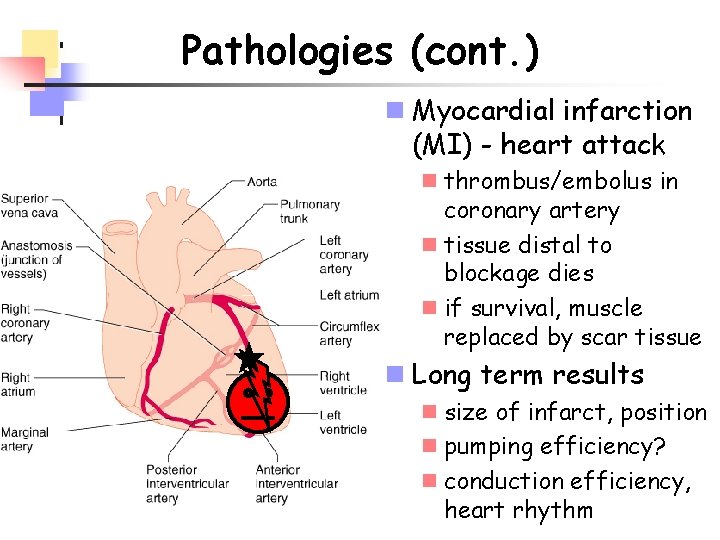 Pathologies (cont. ) n Myocardial infarction (MI) - heart attack n thrombus/embolus in coronary