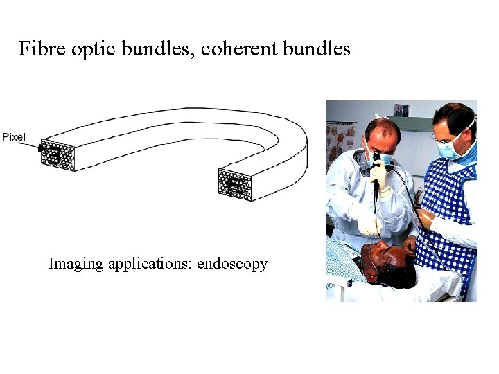 Fibre optic bundles, coherent bundles Imaging applications: endoscopy 