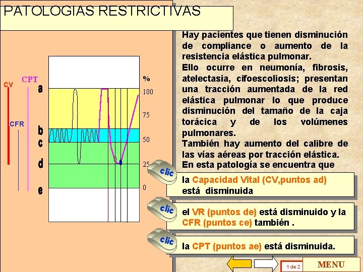 PATOLOGIAS RESTRICTIVAS CV CPT % 100 75 CFR 50 25 clic 0 clic Hay