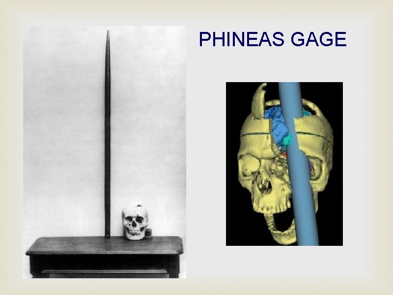 PHINEAS GAGE 