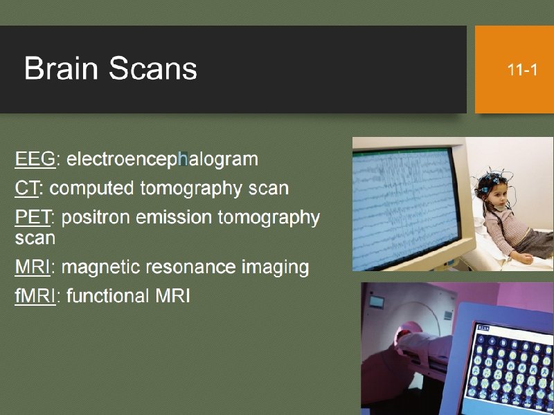 f. MRI Scan When the subject is in the scanner functional magnetic resonance imaging