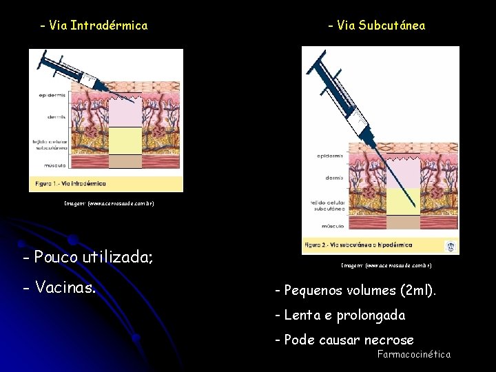 - Via Intradérmica - Via Subcutánea Imagem: (www. acervosaude. com. br) - Pouco utilizada;