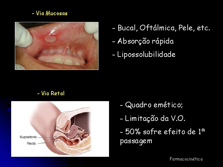 - Via Mucosas - Bucal, Oftálmica, Pele, etc. - Absorção rápida - Lipossolubilidade -