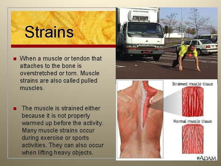 Strains n n When a muscle or tendon that attaches to the bone is