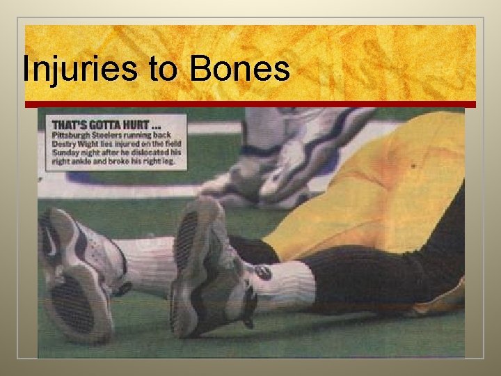 Injuries to Bones 