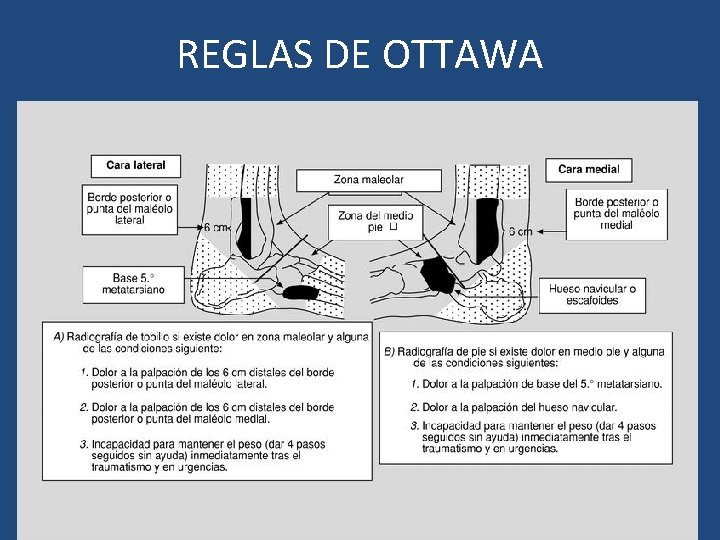 REGLAS DE OTTAWA 