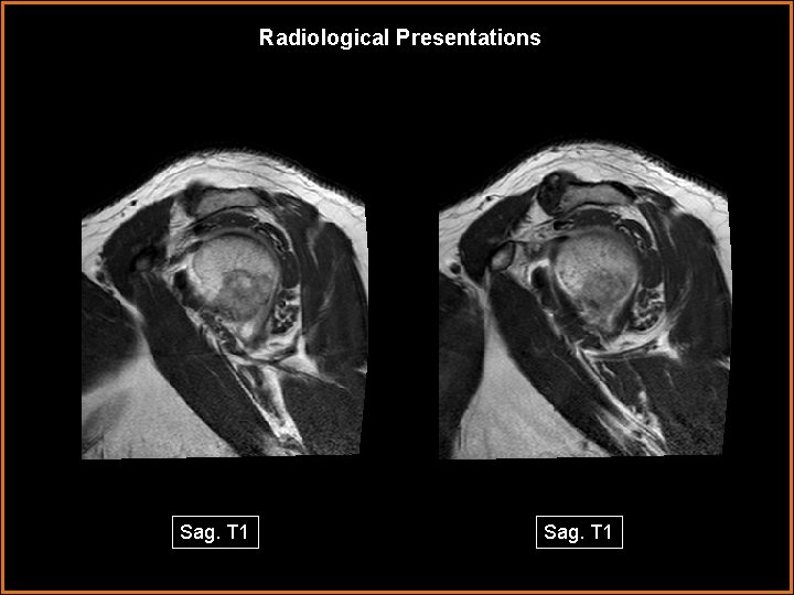 Radiological Presentations Sag. T 1 