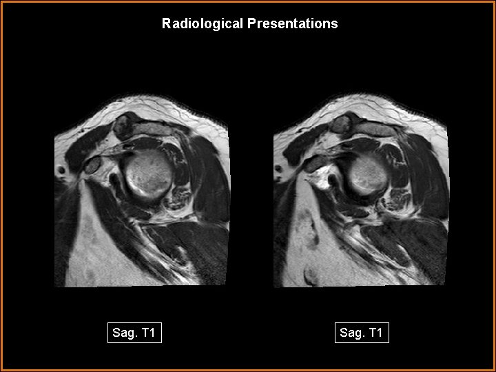 Radiological Presentations Sag. T 1 