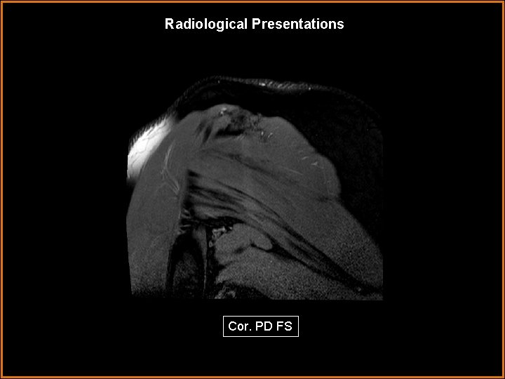 Radiological Presentations Cor. PD FS 