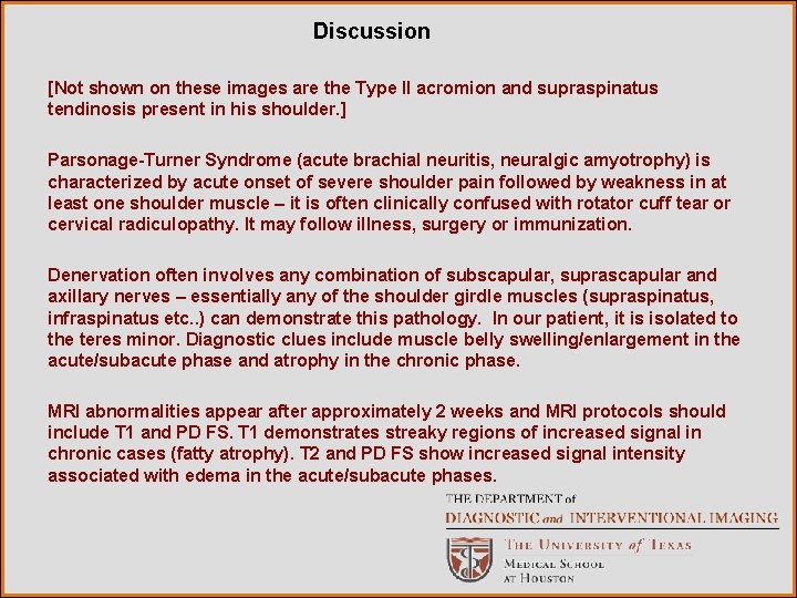 Discussion [Not shown on these images are the Type II acromion and supraspinatus tendinosis