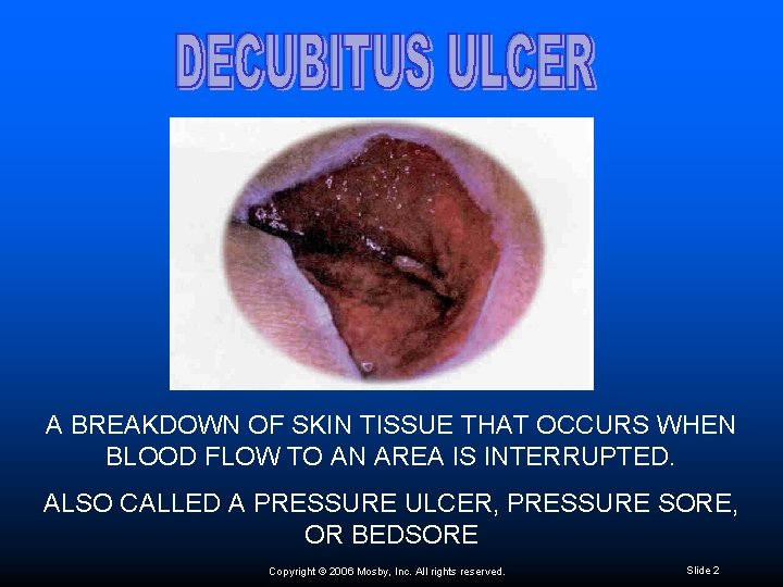 A BREAKDOWN OF SKIN TISSUE THAT OCCURS WHEN BLOOD FLOW TO AN AREA IS