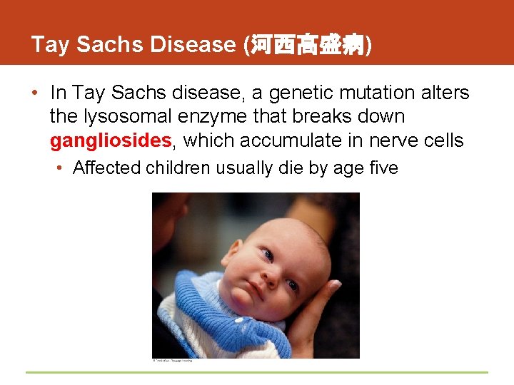 Tay Sachs Disease (河西高盛病) • In Tay Sachs disease, a genetic mutation alters the