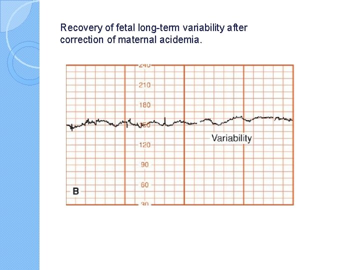 Recovery of fetal long-term variability after correction of maternal acidemia. 