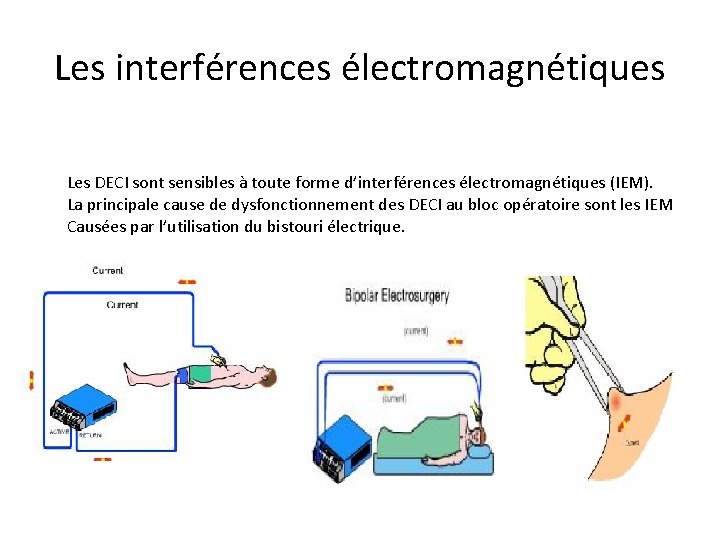 Les interférences électromagnétiques Les DECI sont sensibles à toute forme d’interférences électromagnétiques (IEM). La