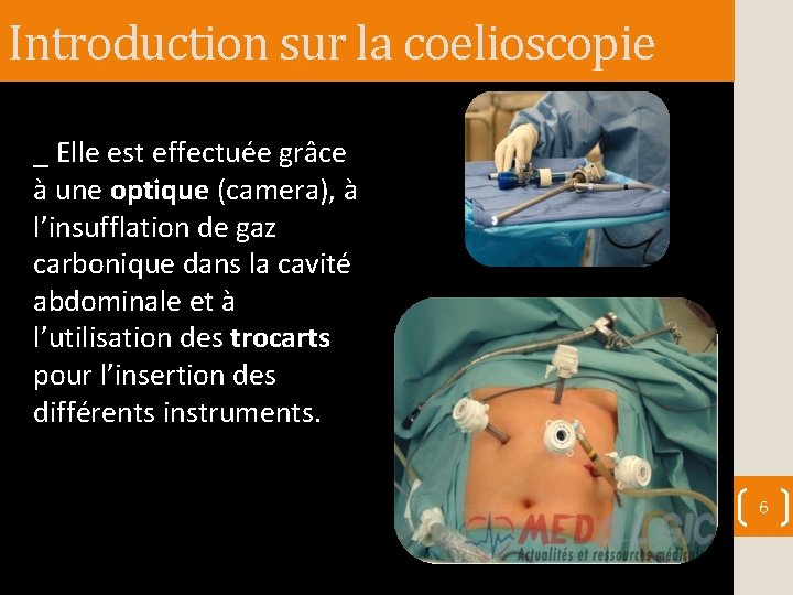 Introduction sur la coelioscopie _ Elle est effectuée grâce à une optique (camera), à