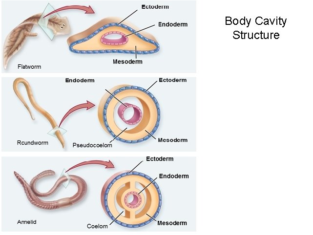 Body Cavity Structure 