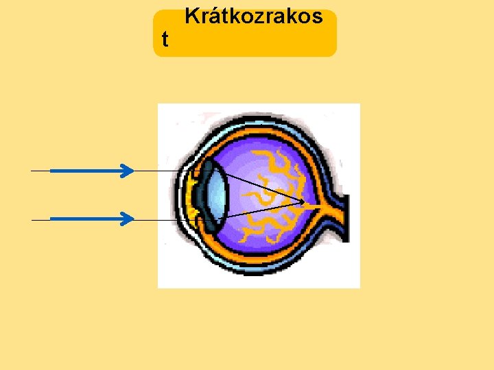 t Krátkozrakos 