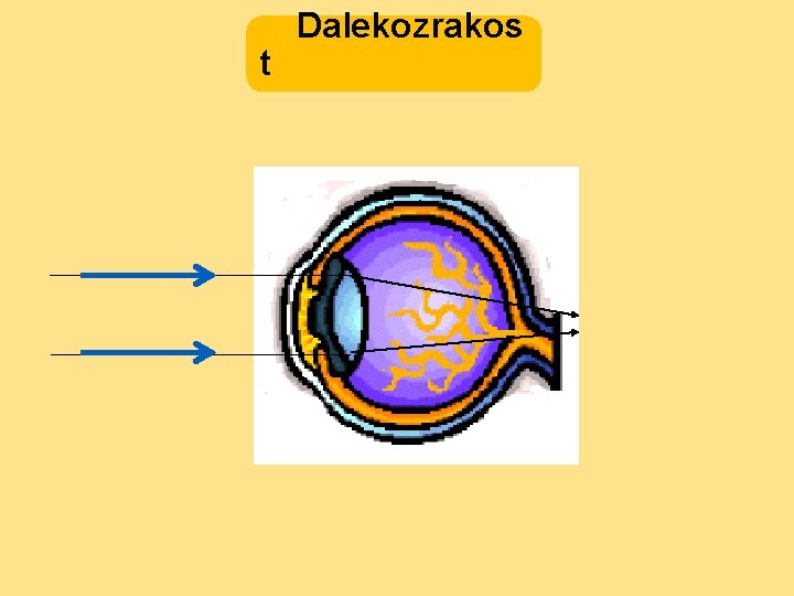 t Dalekozrakos 