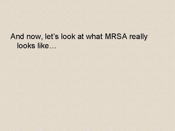 And now, let’s look at what MRSA really looks like… 