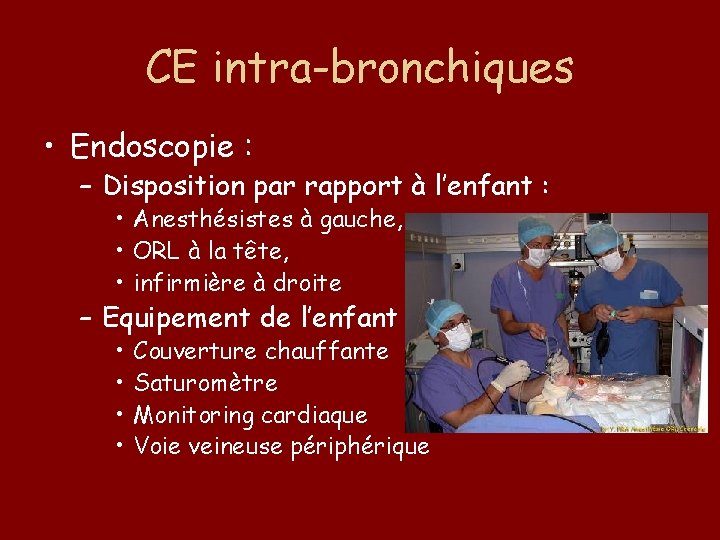 CE intra-bronchiques • Endoscopie : – Disposition par rapport à l’enfant : • Anesthésistes