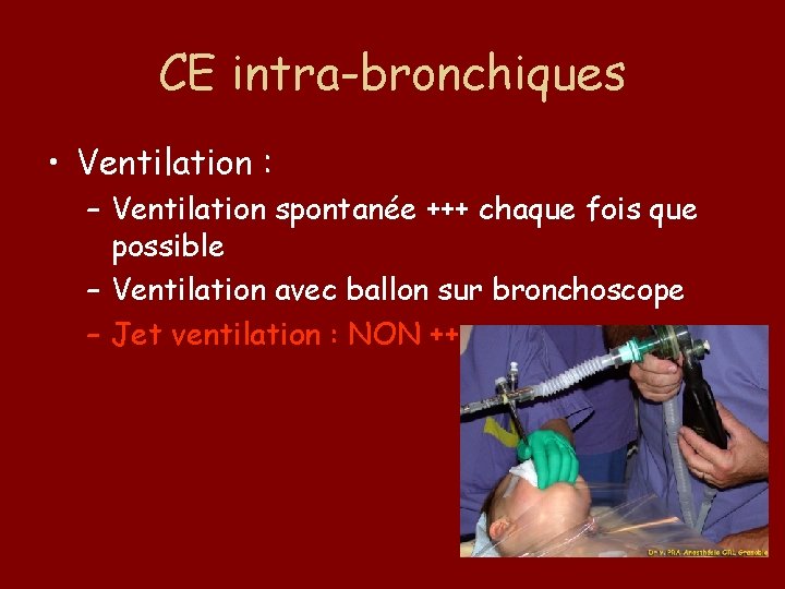 CE intra-bronchiques • Ventilation : – Ventilation spontanée +++ chaque fois que possible –