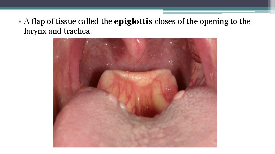  • A flap of tissue called the epiglottis closes of the opening to