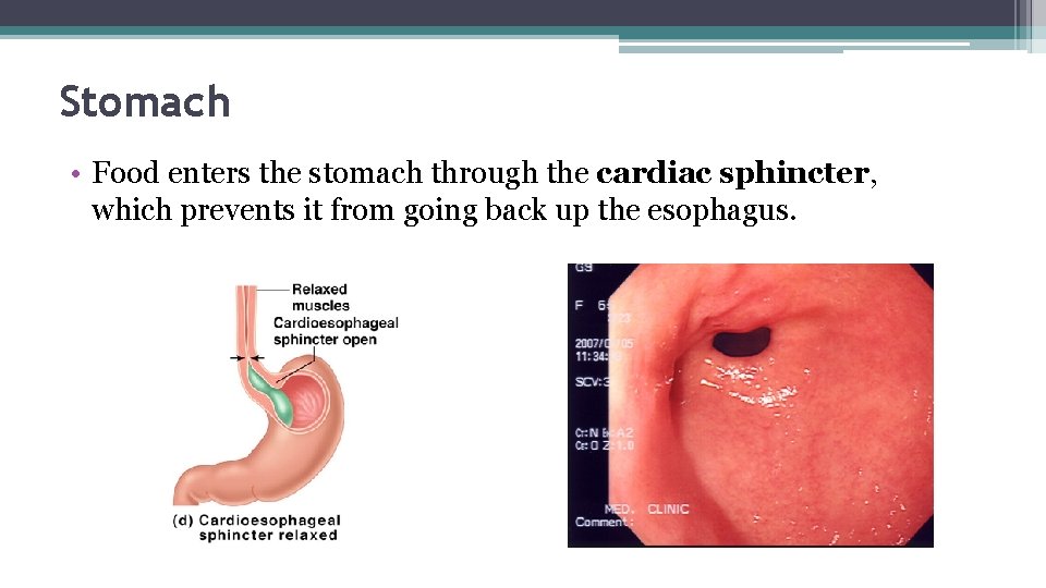 Stomach • Food enters the stomach through the cardiac sphincter, which prevents it from