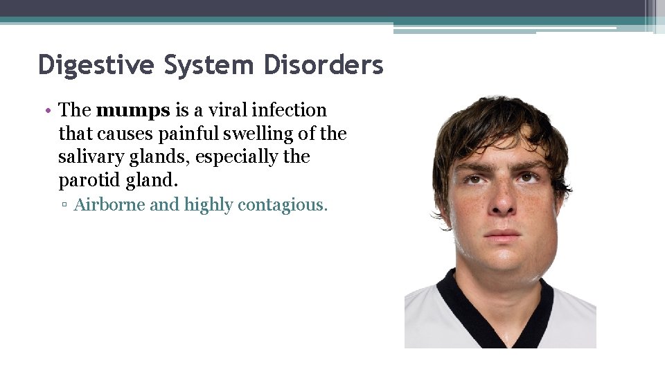 Digestive System Disorders • The mumps is a viral infection that causes painful swelling