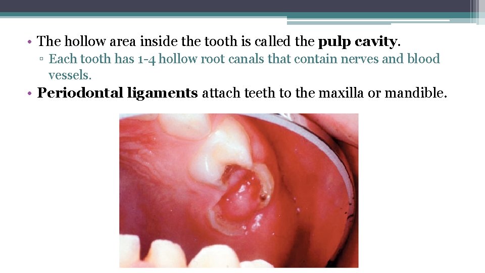  • The hollow area inside the tooth is called the pulp cavity. ▫