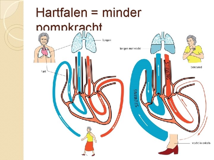 Hartfalen = minder pompkracht 