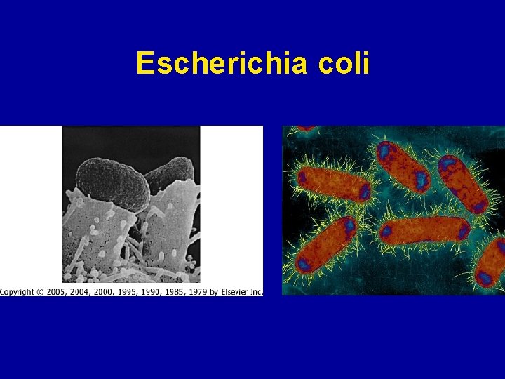 Escherichia coli 