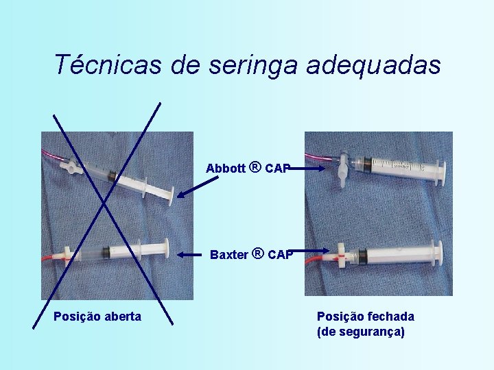 Técnicas de seringa adequadas Abbott ® CAP Baxter ® CAP Posição aberta Posição fechada