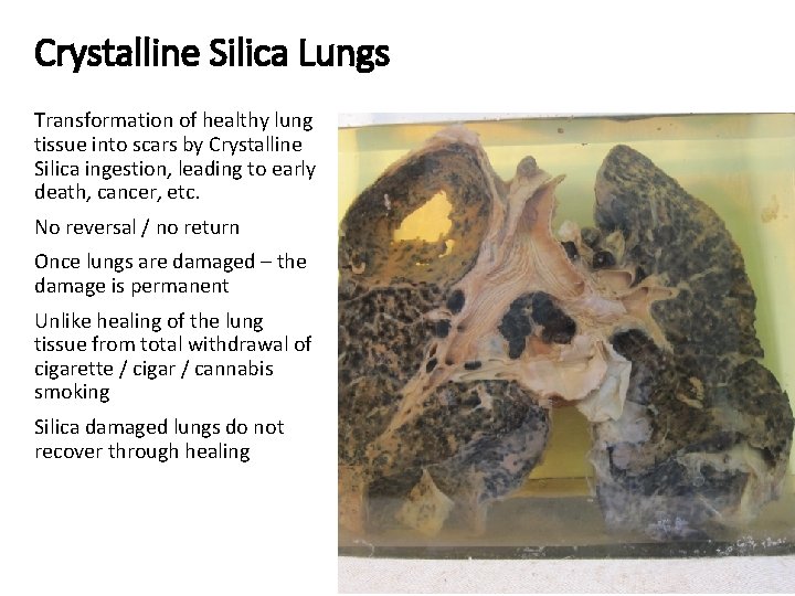 Crystalline Silica Lungs Transformation of healthy lung tissue into scars by Crystalline Silica ingestion,