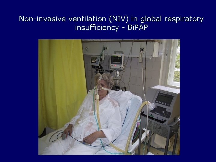 Non-invasive ventilation (NIV) in global respiratory insufficiency - Bi. PAP 