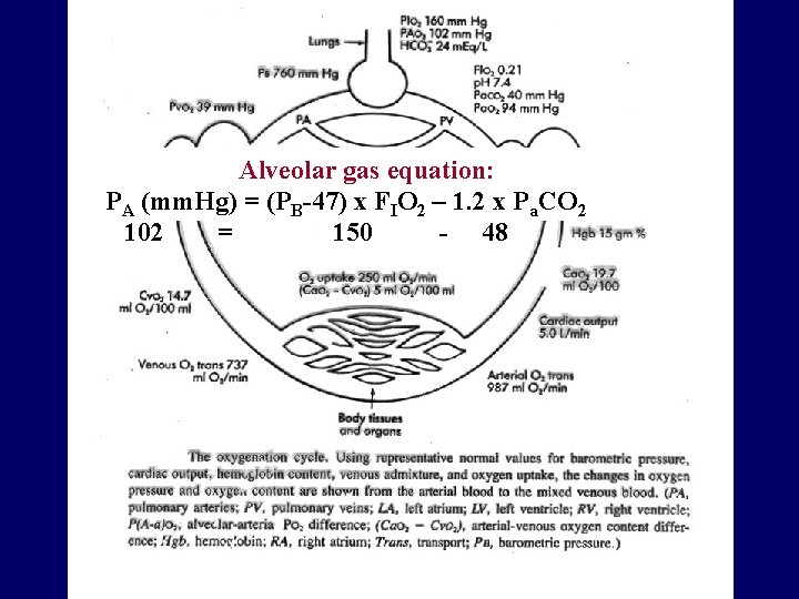 Alveolar gas equation: PA (mm. Hg) = (PB-47) x FIO 2 – 1. 2