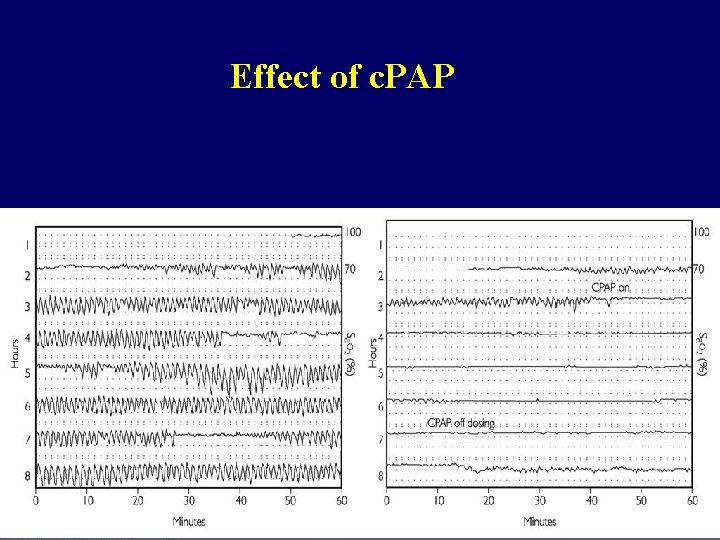 Effect of c. PAP 