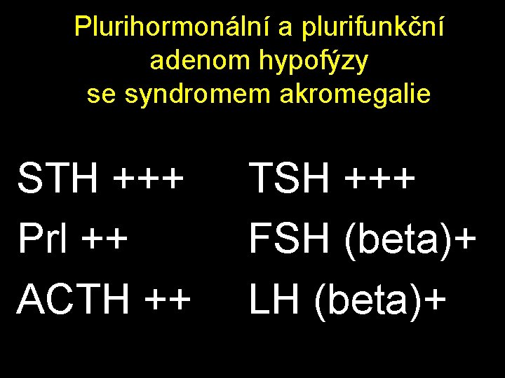 Plurihormonální a plurifunkční adenom hypofýzy se syndromem akromegalie STH +++ Prl ++ ACTH ++