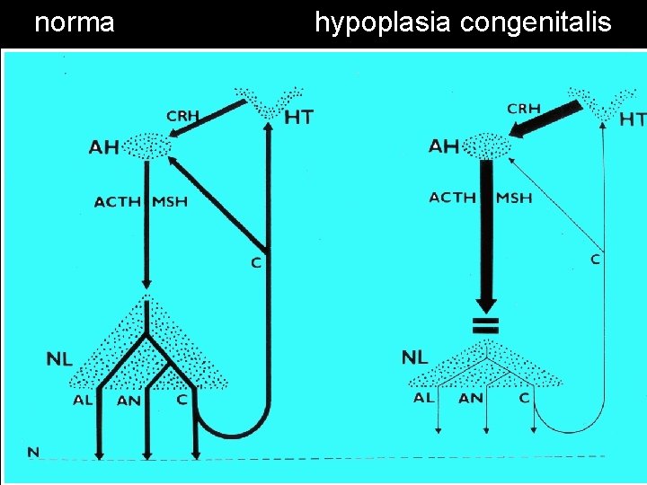 norma hypoplasia congenitalis 