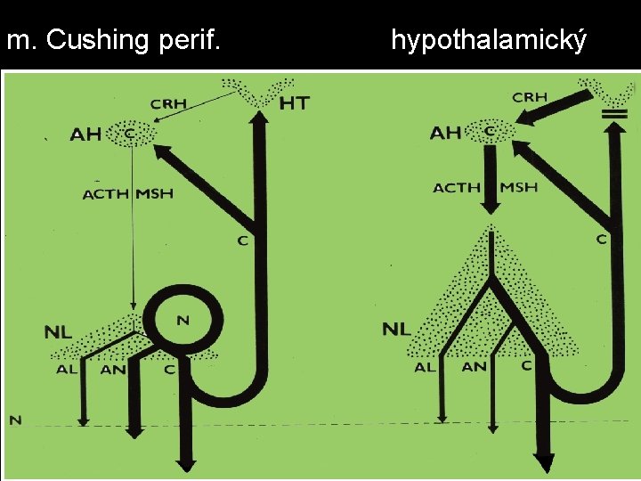 m. Cushing perif. hypothalamický 