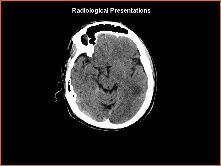 Radiological Presentations 