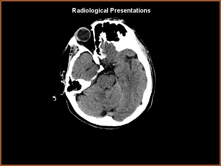 Radiological Presentations 