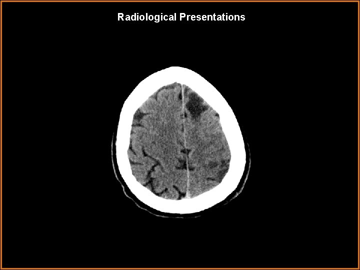 Radiological Presentations 