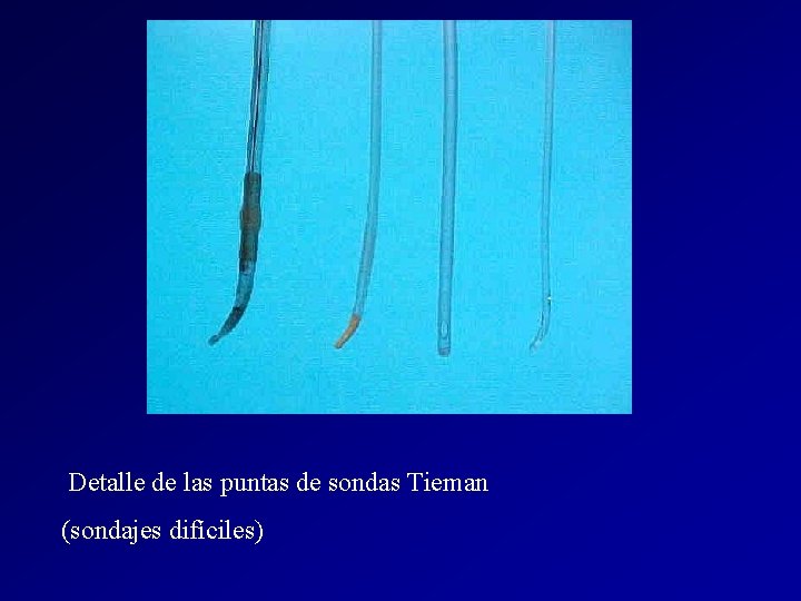 Detalle de las puntas de sondas Tieman (sondajes difíciles) Detalle de las puntas de sondas Tieman (sondajes difíciles)