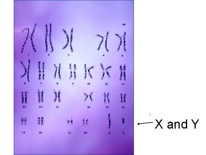 X and Y X and Y