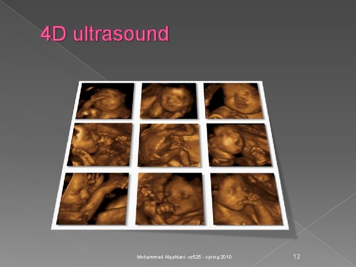 4 D ultrasound Mohammed Alqahtani -cs 525 - spring 2010 12 