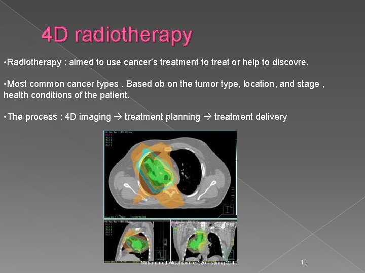 4 D radiotherapy • Radiotherapy : aimed to use cancer’s treatment to treat or