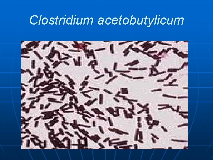 Clostridium acetobutylicum 