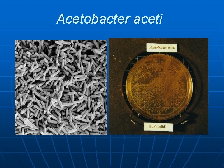 Acetobacter aceti 
