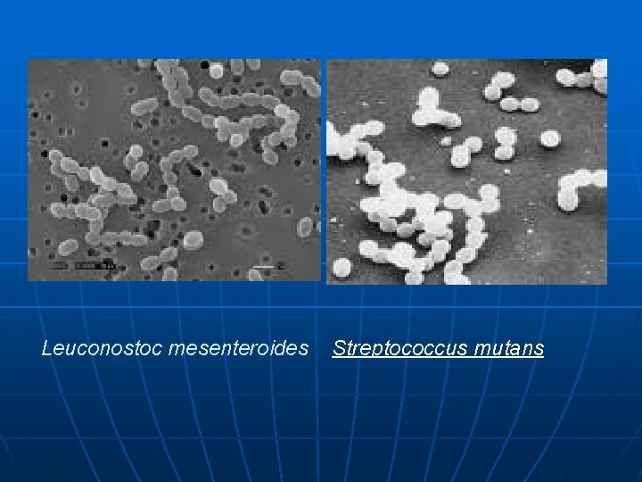 Leuconostoc mesenteroides Streptococcus mutans 